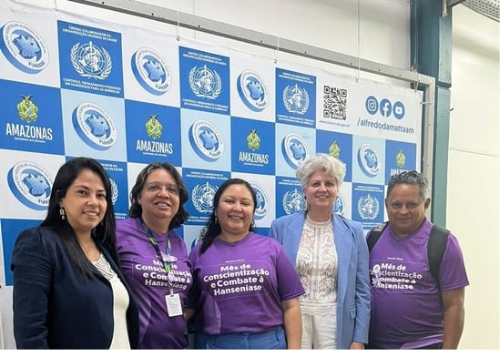 Fuham firma parceria com ONG para fortalecimento da produção de calçados terapêuticos