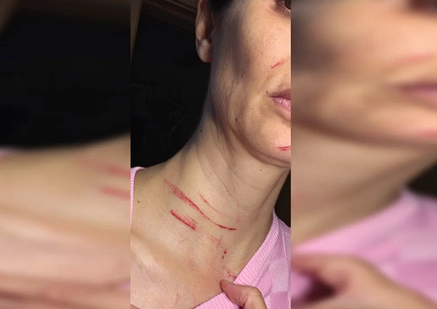Enfermeira é agredida dentro de hospital público do DF
