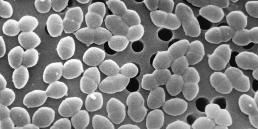 Ingerir açúcar durante o tratamento com antibióticos pode prejudicar a microbiota intestinal